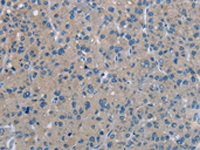 Anti-PHKA1 Antibody