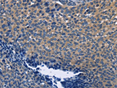 Anti-SYT17 / Synaptotagmin 17 Antibody