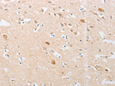 Anti-CDKN2AIP Antibody
