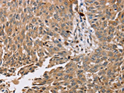 Anti-PDLIM7 Antibody