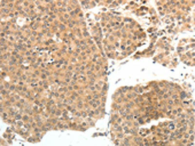 Anti-PSMD7 Antibody
