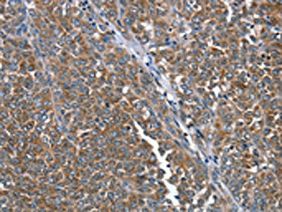 Anti-PTRH2 Antibody