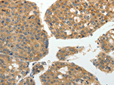 Anti-GRK4 / G protein-coupled receptor kinase 4 Antibody
