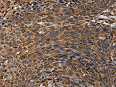 Anti-HIF1aN / HIF1 alpha subunit inhibitor Antibody
