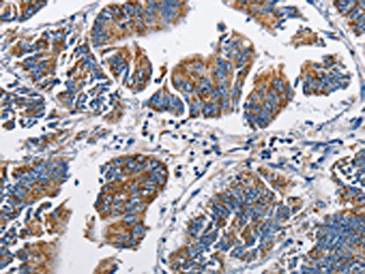 Anti-NPPA Antibody