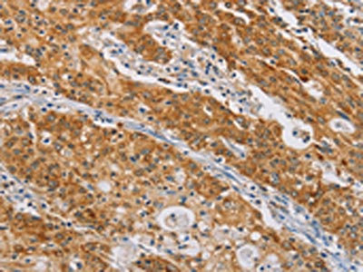 Anti-CENPE / Centromere protein E Antibody