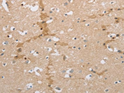 Anti-NCAN Antibody