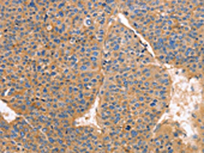 Anti-GNB1 Antibody