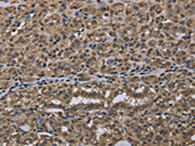 Anti-NLRP6 Antibody