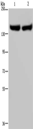 Anti-ITGA2B / CD41 Antibody