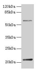 Anti-DUSP13 Antibody