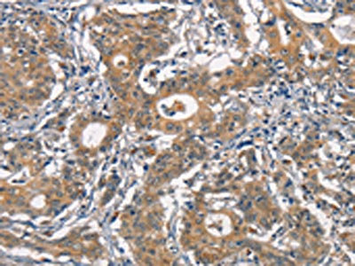Anti-CR2 Antibody