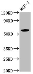 Anti-ILDR1 Antibody