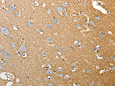 Anti-SLC4A4 Antibody