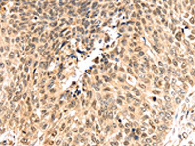 Anti-PSMB8 Antibody