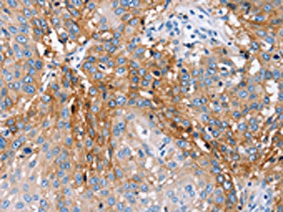 Anti-PLCZ1 Antibody