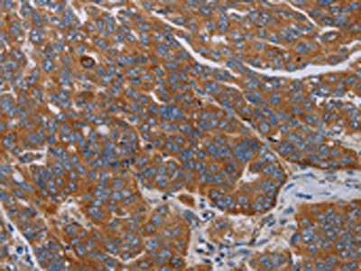 Anti-PARP10 Antibody