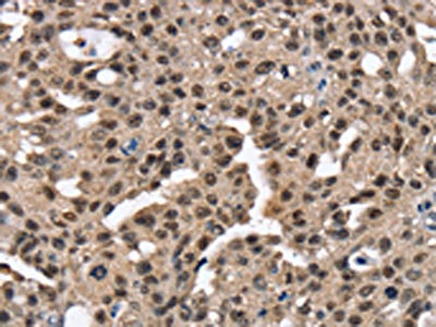 Anti-RNF40 Antibody
