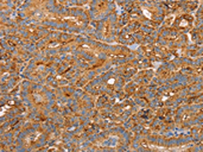 Anti-CD59 Antibody