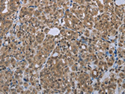 Anti-SMAD4 Antibody