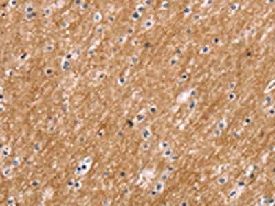 Anti-SLC2A3 Antibody
