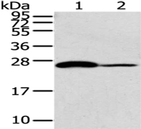 Anti-CD79A Antibody