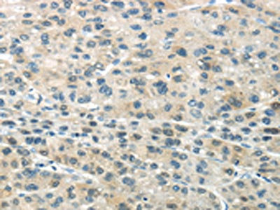 Anti-SMYD2 Antibody