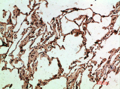 Anti-ADI1 Antibody