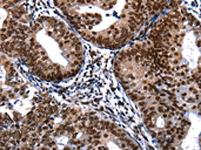 Anti-DFFA / DNA fragmentation factor subunit alpha Antibody
