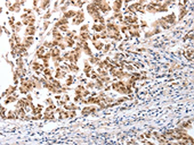 Anti-CTBP2 / C-terminal-binding protein 2 Antibody