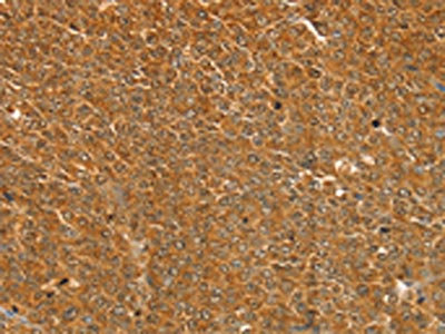 Anti-ST18 Antibody