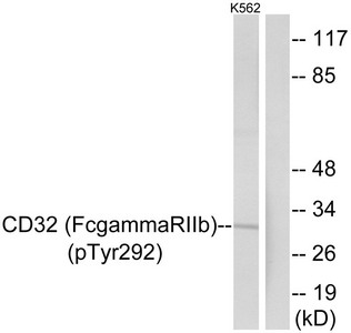 Anti-Phospho-FCGR2B (Tyr292) / CD32 Antibody