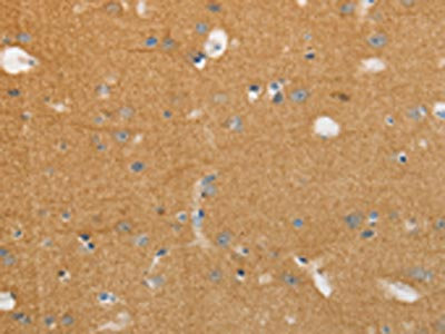 Anti-NFASC Antibody