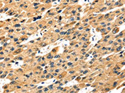 Anti-STX7 / Syntaxin 7 Antibody