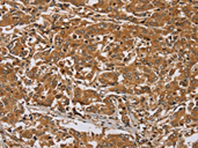 Anti-RAB8A Antibody