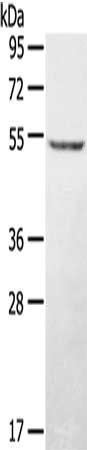 Anti-STYK1 / Serine/threonine/tyrosine kinase 1 Antibody