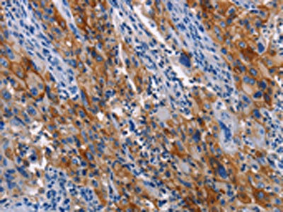 Anti-ICAM1 / Intercellular adhesion molecule 1 Antibody