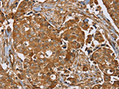 Anti-RAB14 Antibody