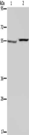 Anti-PHGDH Antibody