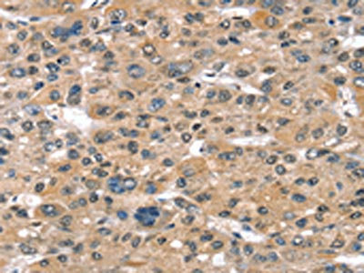 Anti-SULT1B1 / Sulfotransferase family cytosolic 1B member 1 Antibody