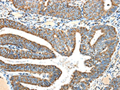 Anti-NDUFA5 Antibody