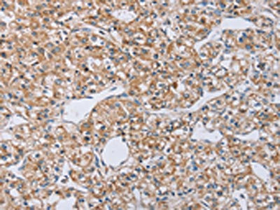 Anti-EDA / Ectodysplasin-A Antibody