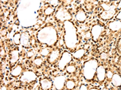 Anti-AGPAT9 Antibody