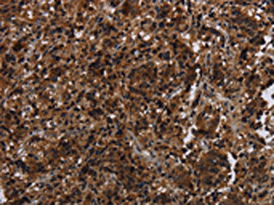Anti-MAGEE1 Antibody
