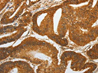 Anti-RETNLB Antibody