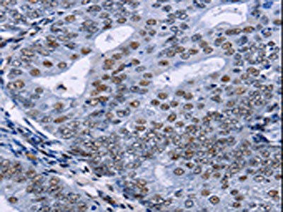Anti-CREBBP Antibody
