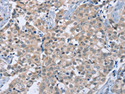 Anti-RAB8B Antibody