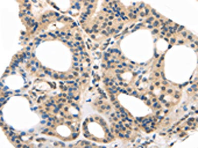 Anti-MED28 Antibody