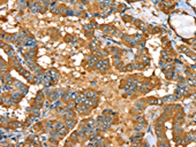 Anti-PYGL Antibody