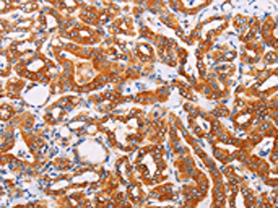 Anti-SYVN1 / Synovial apoptosis inhibitor 1 Antibody